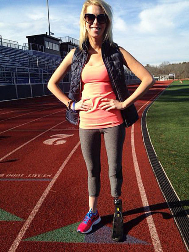 Boston Marathon Bombings Survivor Adrianne Haslet 