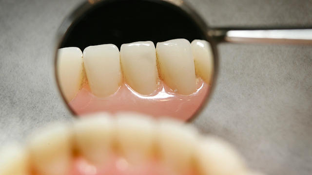 bite-teeth-57371826.jpg 