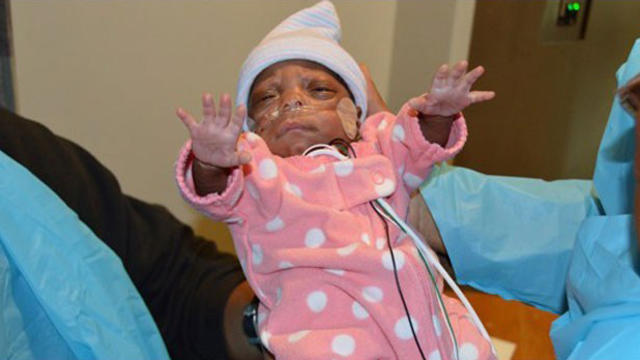 tiny-preemie.jpg 