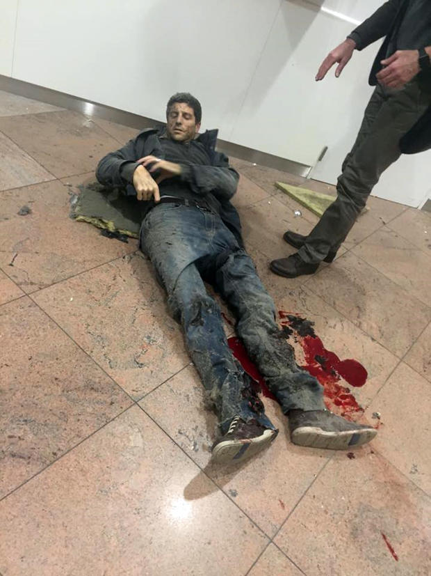 Wounded Belgian basketball player Sebastian Bellin lies on the ground in Zaventem Bruxelles International Airport in Brussels after explosions ripped through the departure hall on March 22, 2016. 