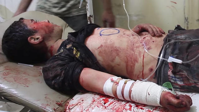 ​A boy injured in a strike that destroyed the al-Quds hospital in southern Aleppo, Syria, recieves treatment at another facility in the front-line city, in a screengrab from video posted online by Syrian anti-government activists 