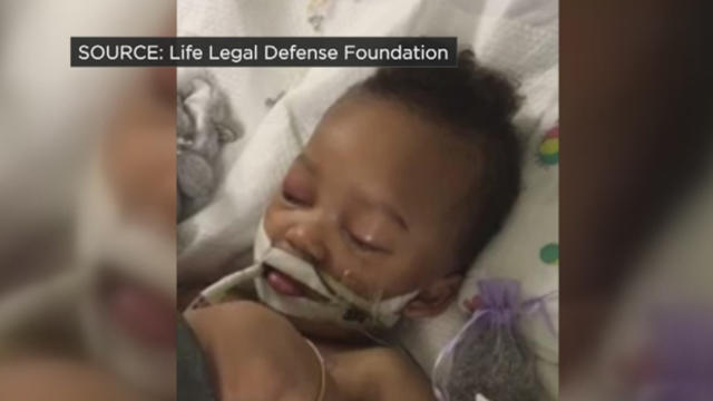 Two hospitals have ruled 2-year-old Israel Stinson brain dead, but his parents say he's still alive. 