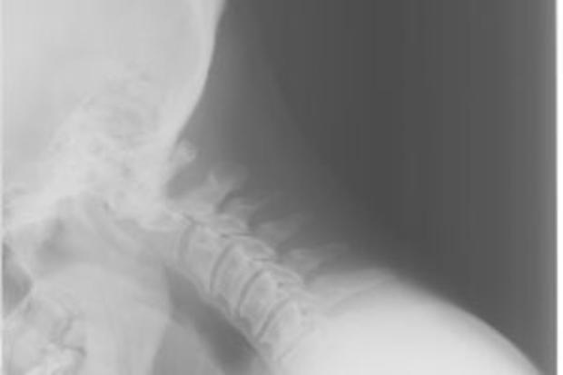 neck-x-ray.jpg 