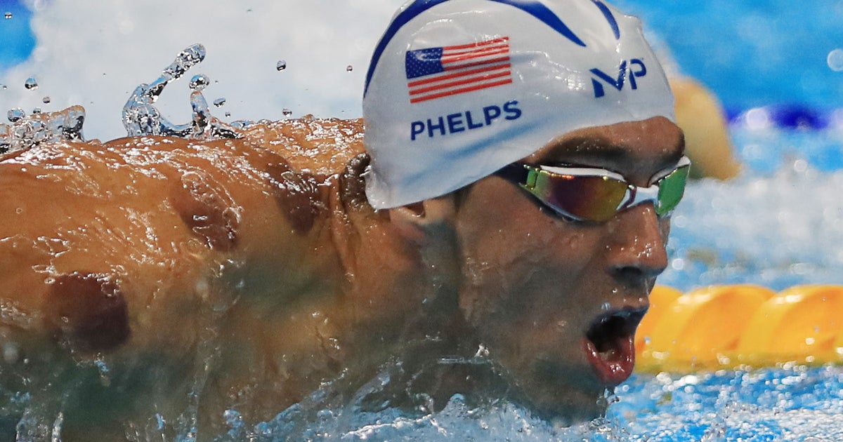Why is "cupping" attracting Olympic athletes like Michael Phelps? CBS
