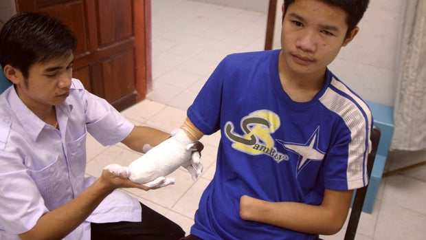 laos-bomb-victim.jpg