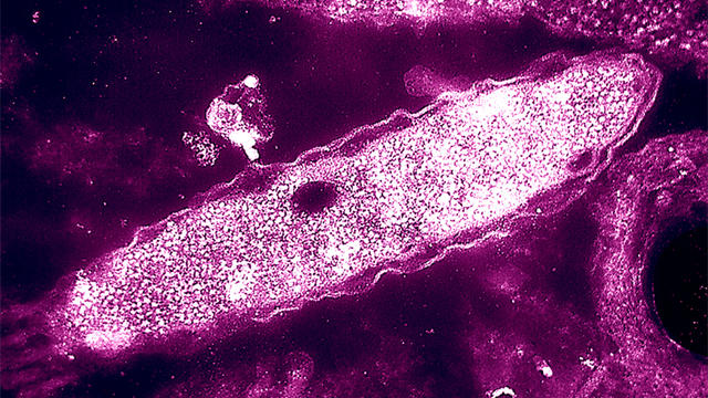 legionella-bacteria.jpg 