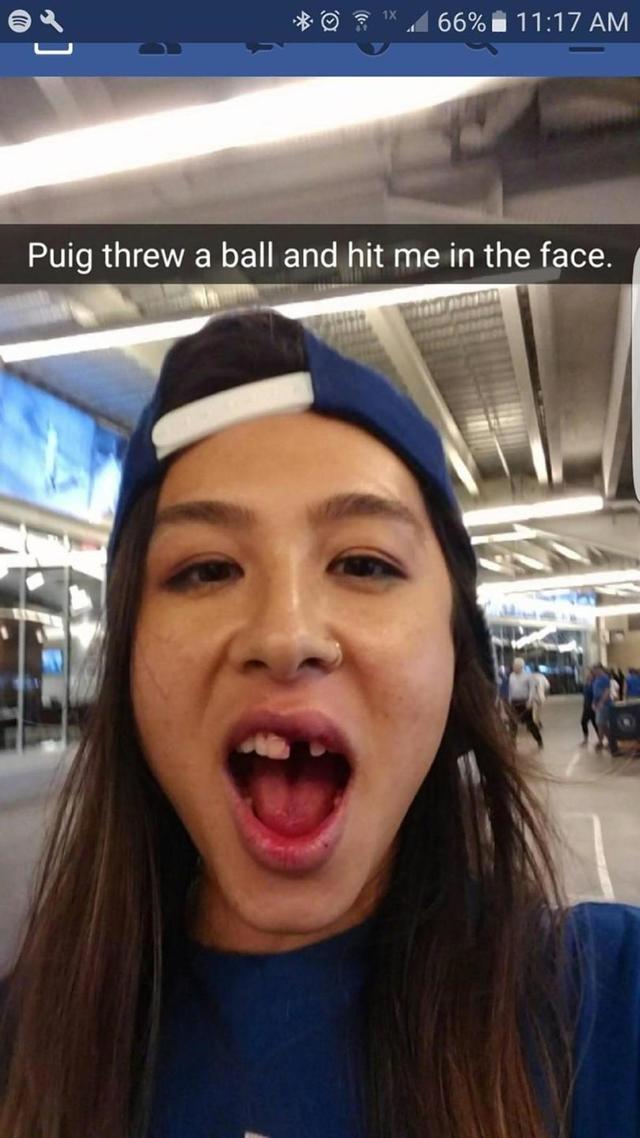 Yasiel Puig knocks out Dodgers fan's tooth with ball, sends her on