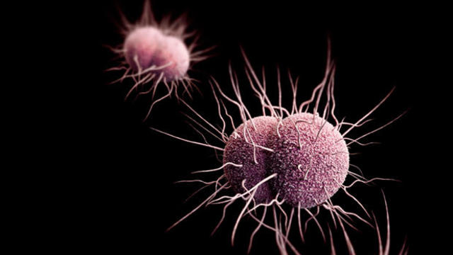 gonorrhea-bacteria-cdc.jpg 