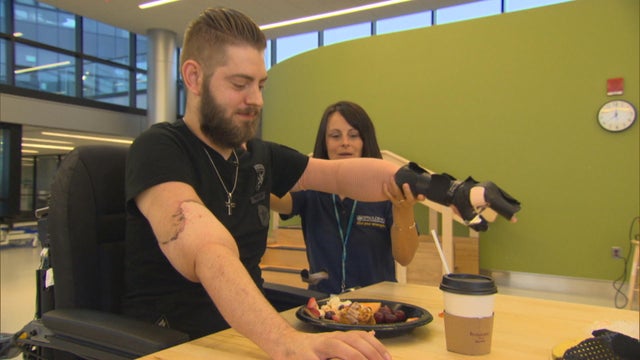 ctm-1005-double-arm-transplant-john-peck.jpg 