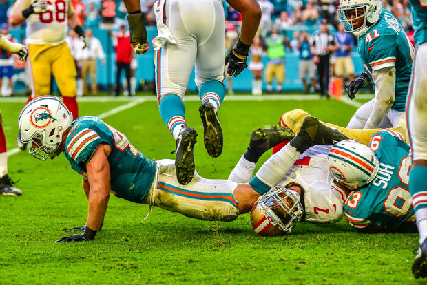 49ers-at-dolphins-63.jpg 