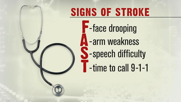 ctm-0309-stroke-signs.jpg 