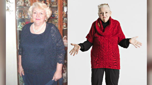 Grandmother's 140-pound tumor removed 