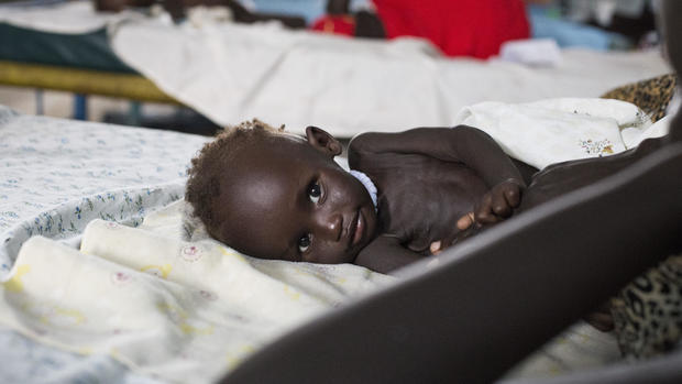 Starving in South Sudan 