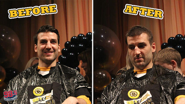 patrice-bergeron-before-and-after.jpg 