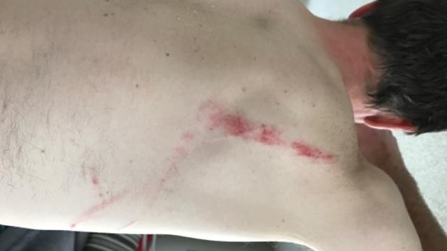 biker-attacked-2.jpg 