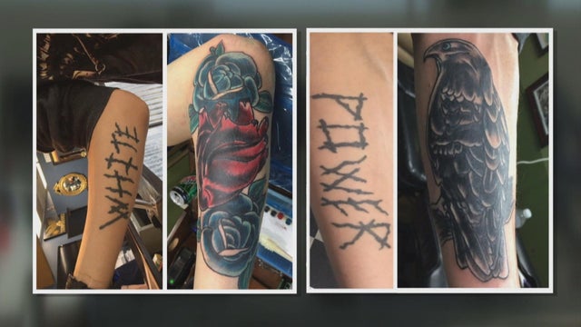 tattoo-removal-1.jpg 
