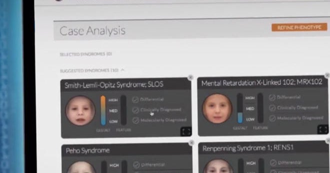 How new technologies aid diagnosis of disorders - CBS News