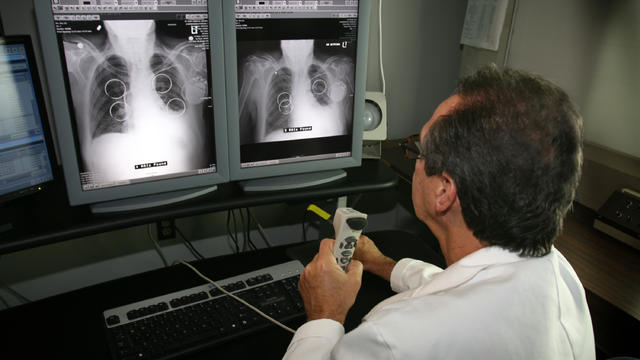 lung-study.jpg 