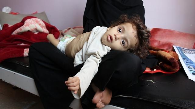 yemenchild2-1443785-640x360.jpg 