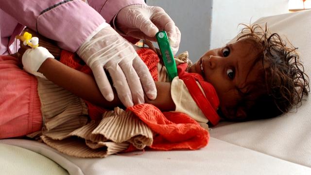 yemenchildwithcholera-1445872-640x360.jpg 