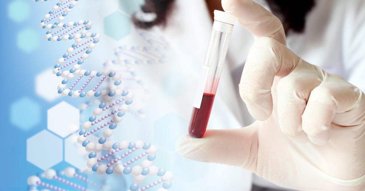 Excitement as early blood test for 8 types of cancer advances - CBS News