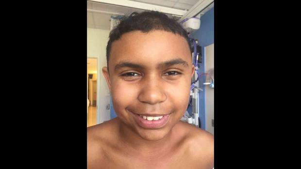 Boy's skull pierced with screw in treehouse-building accident 