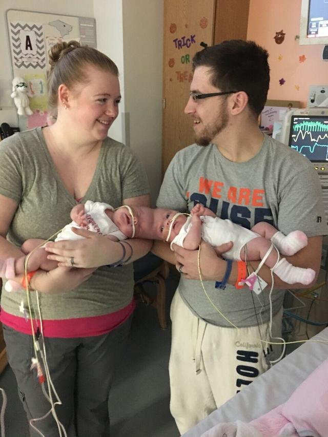 Conjoined twins Abby and Brittany Hensel dream of getting married and  having children of their own