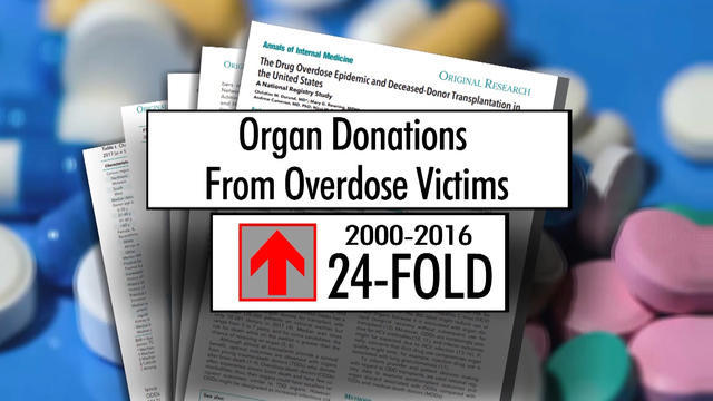 cbsn-fusion-opioid-epidemic-organ-donations-thumbnail-1547649-640x360.jpg 