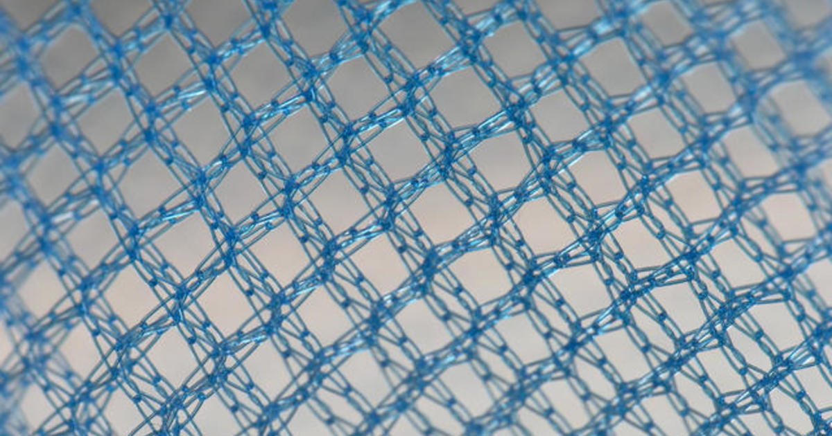 What does pelvic mesh do and why are women suing over it? – explainer, Health