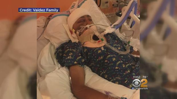 Hit-And-Run Leaves NJ Teen In A Coma 