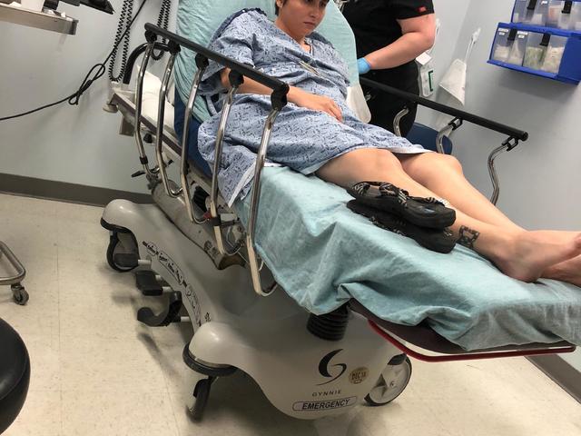 Brown recluse spider bite led to leg being amputated, woman says