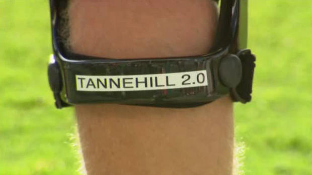 Tannehill Brace 2.0 