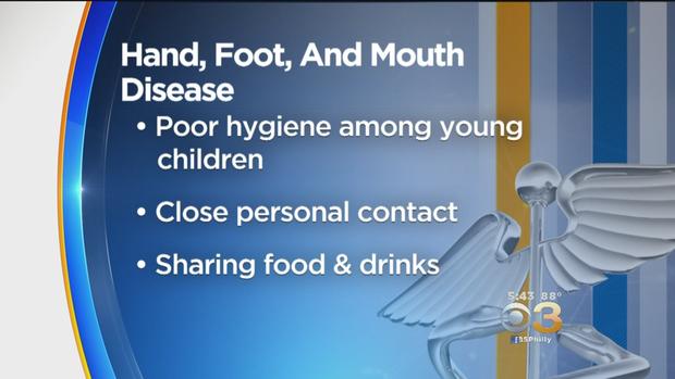Hand Foot Mouth Disease Graphic 