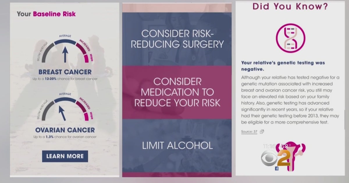 New Weapon To Beat Breast Cancer Before It Begins - CBS New York