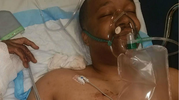Timothy Loving, Berkeley man shot by landlord in hospital 