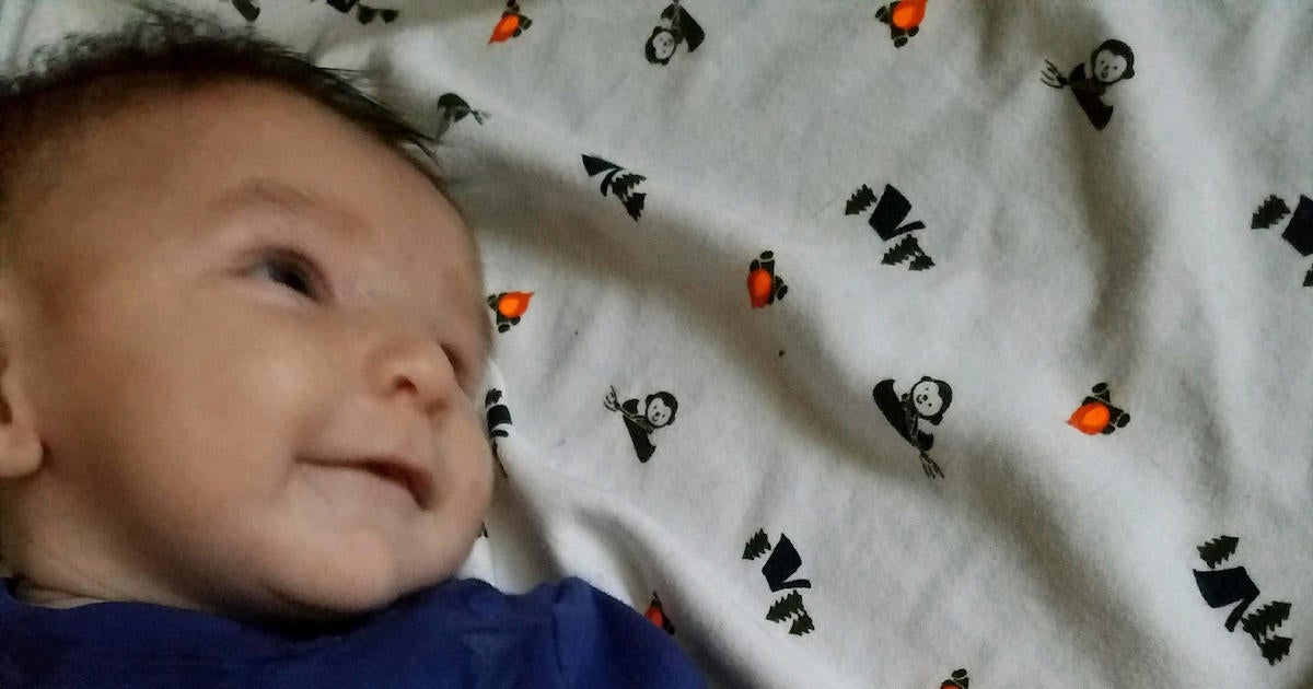 Iowa baby Sterling Koehn "died of diaper rash" prosecutor says; Zachary
