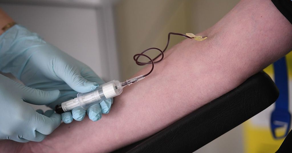 Severe Blood Shortage Nationwide Impacting Minnesota Hospitals CBS