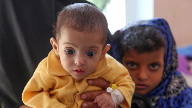 Yemen's humanitarian crisis 