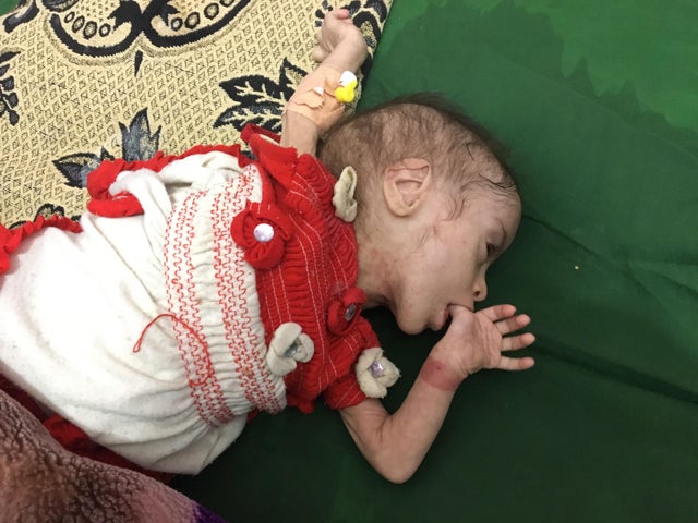 starving-in-yemen.jpg 