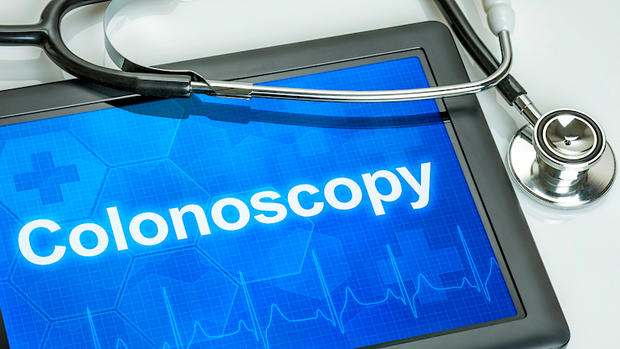 Colonoscopy generic 