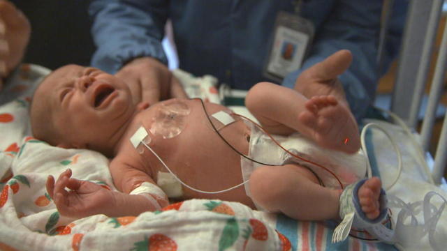ctm-0301-premature-babies-sensors.jpg 