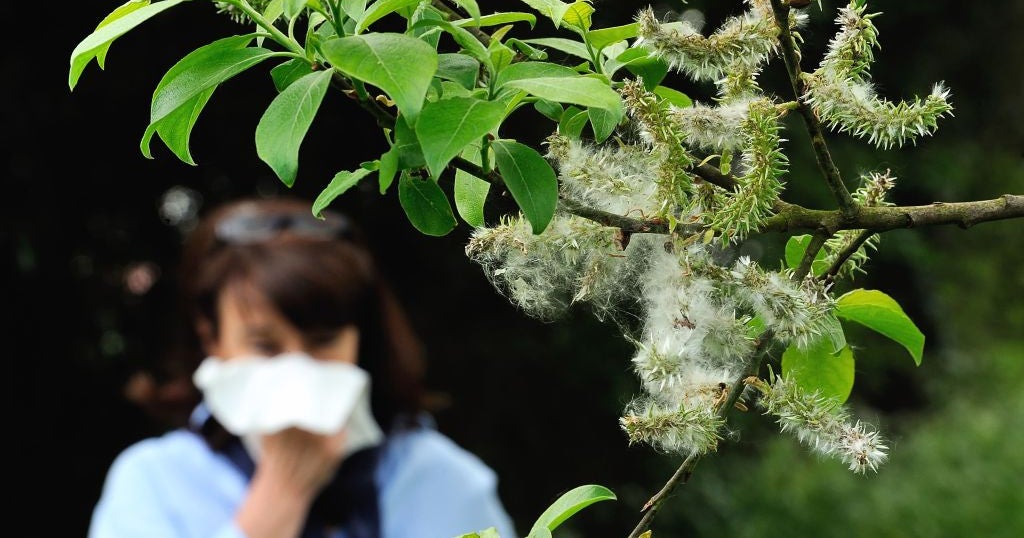 Seasonal Allergies Primed To Bring Misery To Bay Area Residents CBS