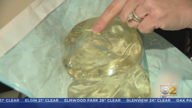 breast-implant-dangers.jpg 