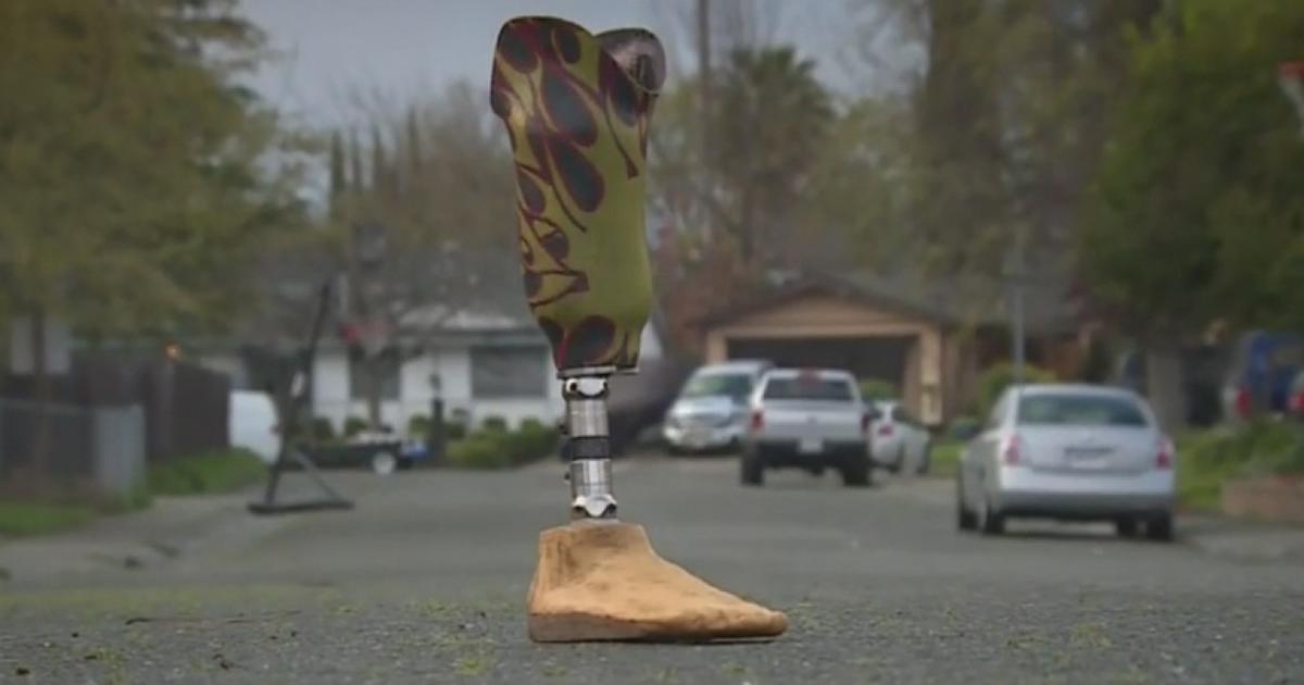 Woman Looking For Owner Of Prosthetic Leg Found In Bushes Good Day