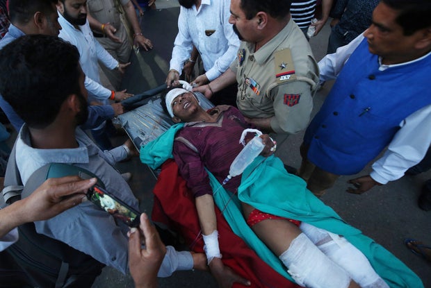 A civilian, who according to the local media, was injured in a cross -border bombing near the control line (LOC) with Pakistan in the Poonch sector, is taken to a hospital in Jammu