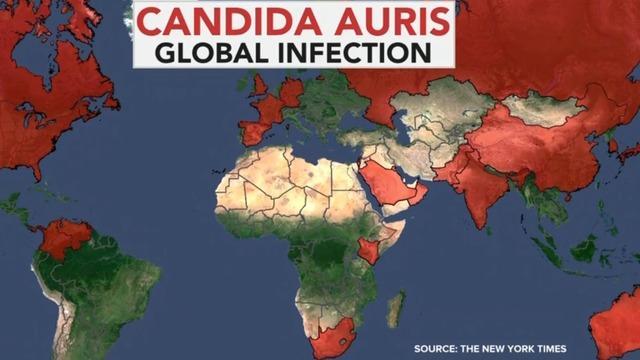 cbsn-fusion-candida-auris-outbreak-superbug-fungus-sickens-hundred-worldwide-thumbnail-1824445-640x360.jpg 