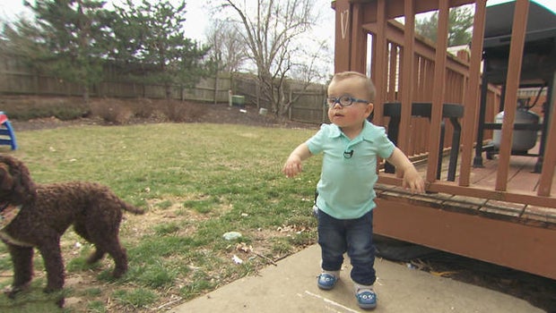 2-year-old with spina bifida now running after taking inspiring first steps