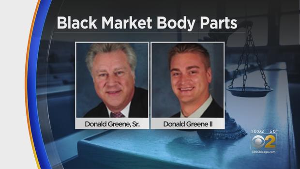 Black market body parts 