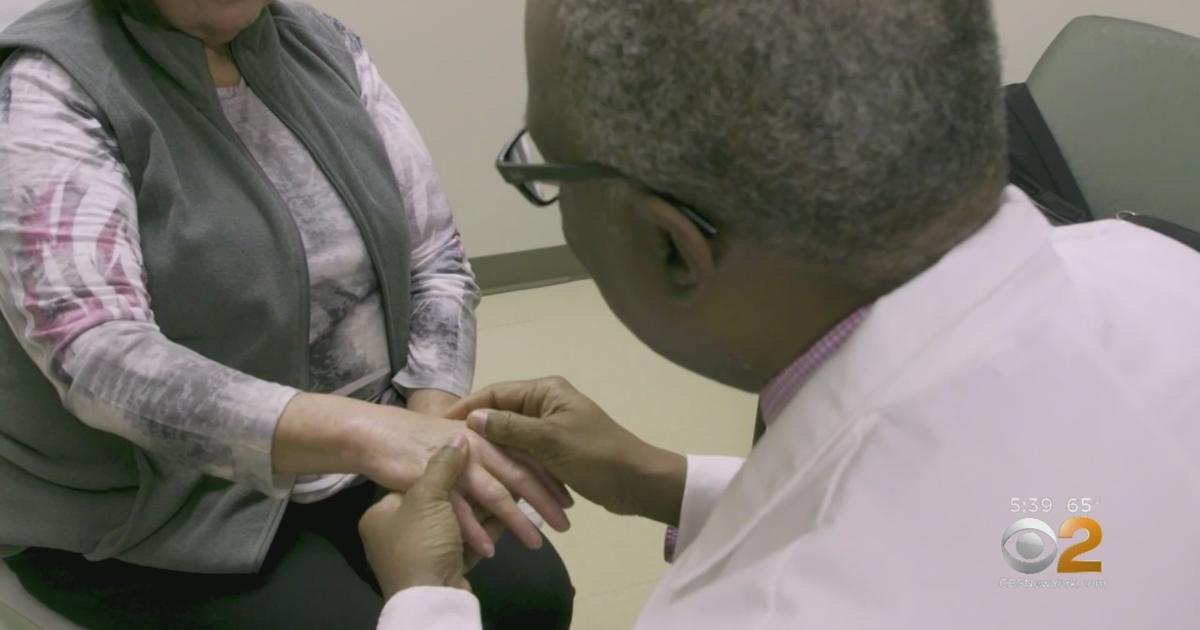 New Test May Help Detect The Often Misdiagnosed Condition Fibromyalgia - CBS  New York