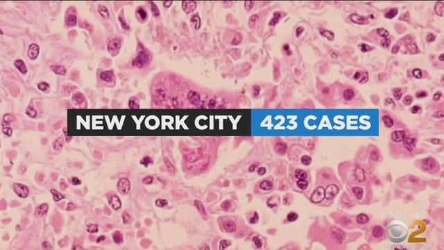 nyc-measles-4.30.jpg 